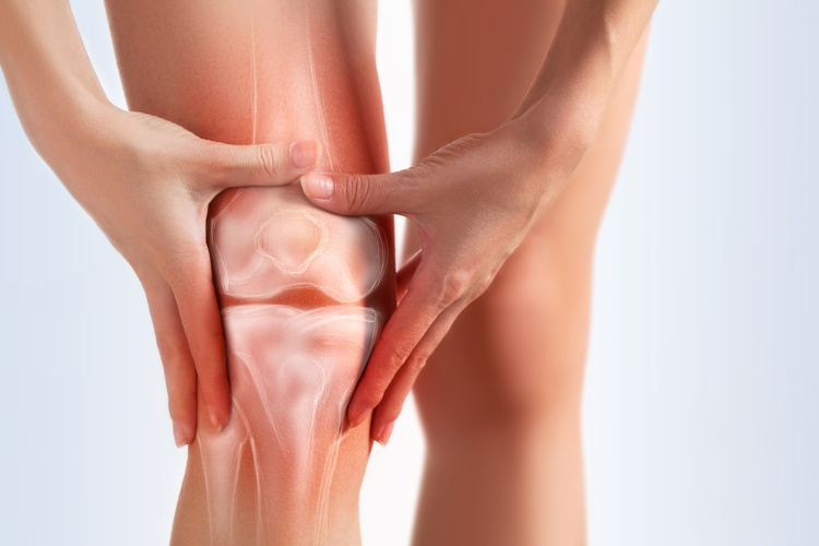 Cannabis and arthritis in the knee