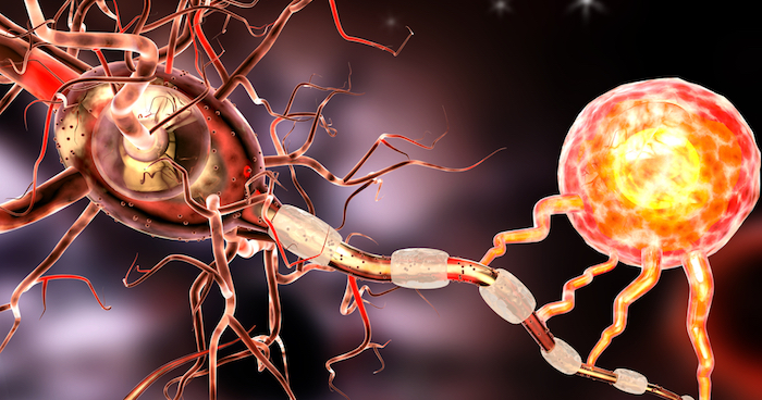 Muscle Spasm Treatment Neurological diseases nerve cells